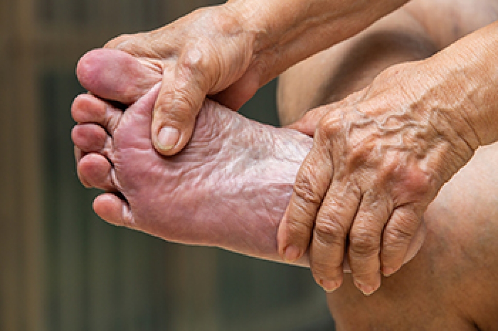 Foot Conditions Linked to Aging