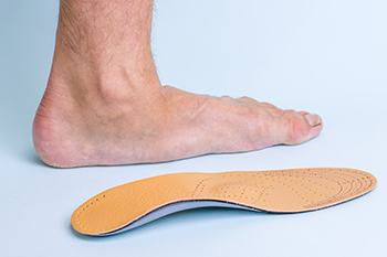 If you have flat feet should you wear arch support 2025