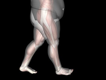 Heel Pain and Obesity